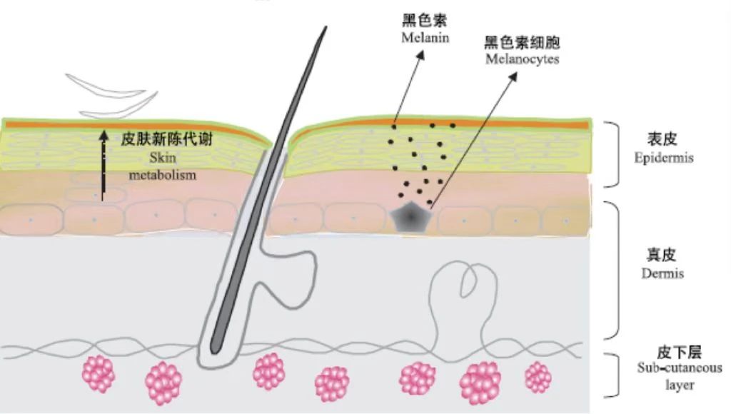 增生型外阴白斑有哪些明显的症状？